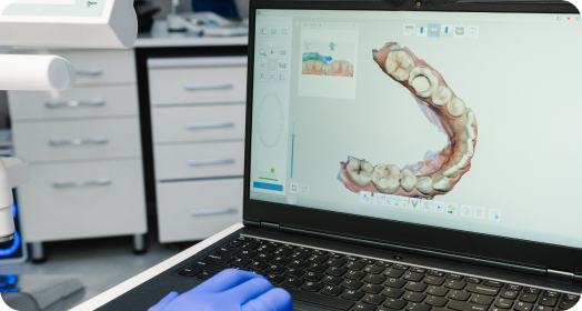 visuel empreinte optique technologie