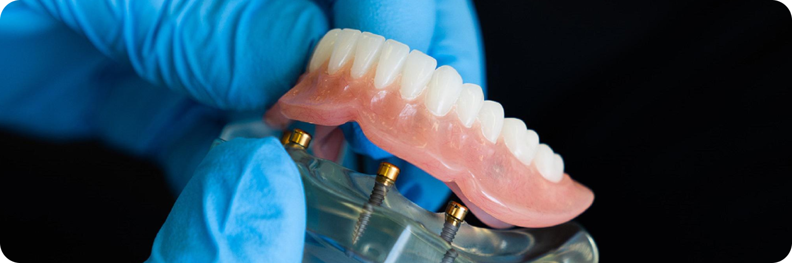  Cabinet dentaire santy traitement parodonthologie