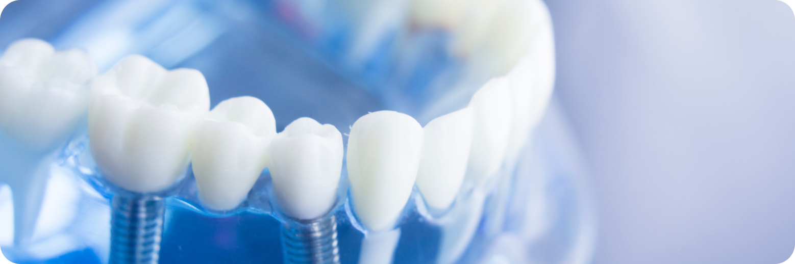  Cabinet dentaire santy traitement implantologie